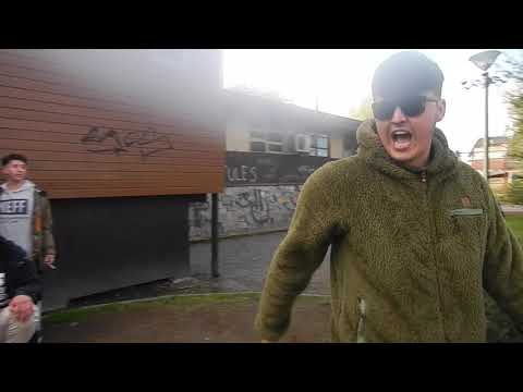 ANTHONY VS SKIZO 8VOS