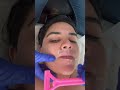 I Did Laser Hair Removal AT Home ‍ 🫣 Ashortaday