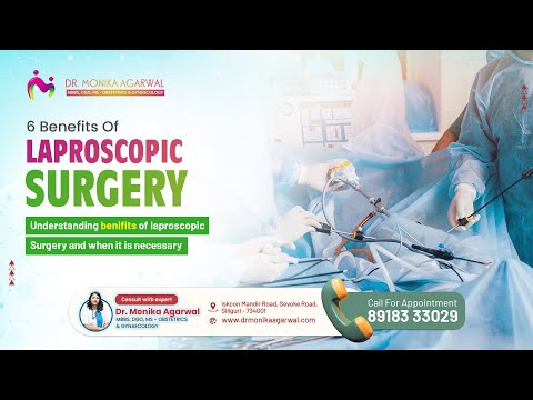 Laparoscopic surgery