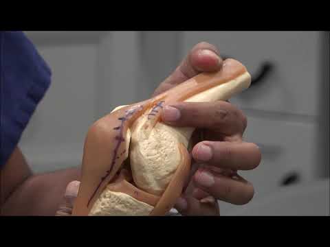 Dr. Manish Patel explains the Jiffy Knee vs. how other surgeons do the surgery.