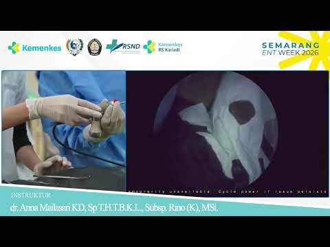 Endoscopic DCR & Orbital Decompression — dr. Anna Mailasari, Sp.T.H.T.B.K.L., Subsp.Rino(K), MSi.Med