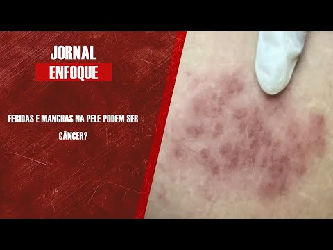 Médico Rogério Dedivitis fala dos cuidados com doenças