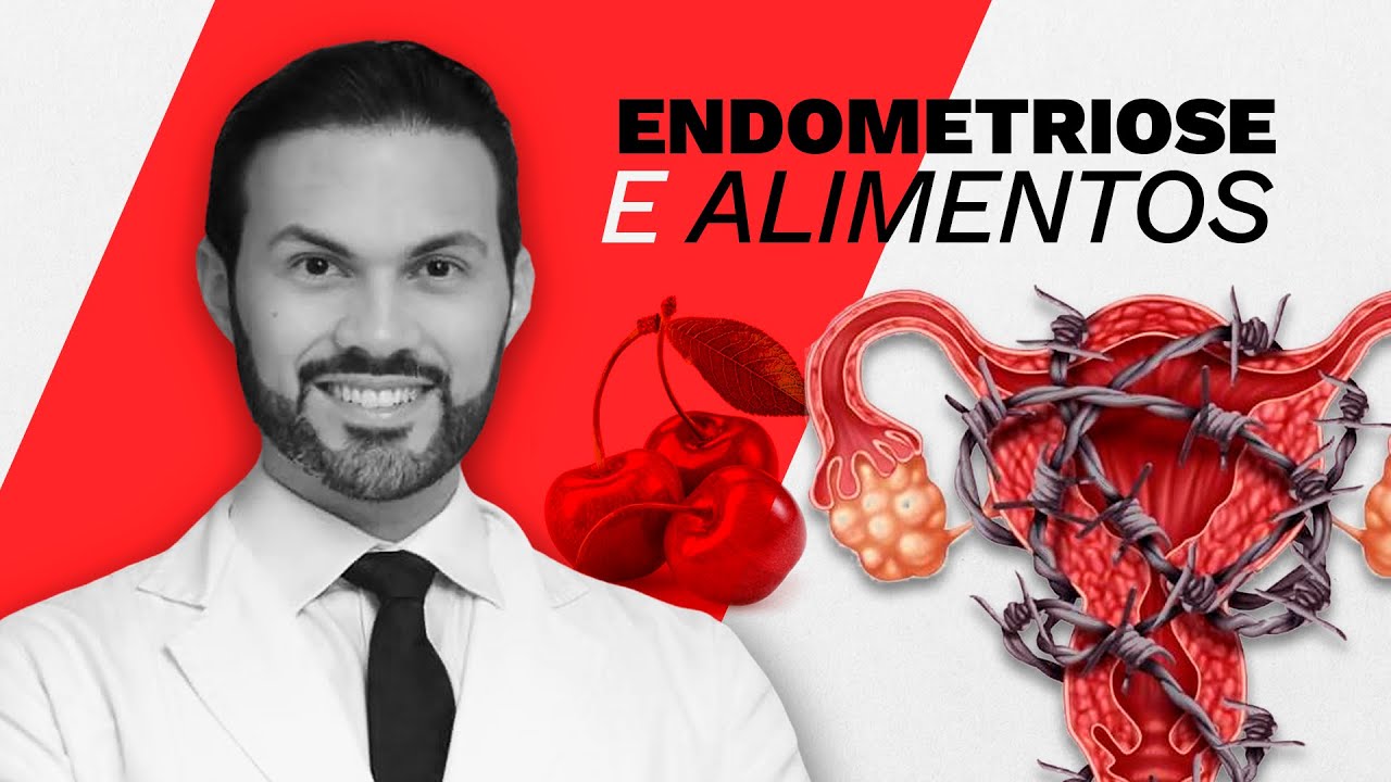 Alimentação como tratamento para ENDOMETRIOSE. |  Dr. André Vinícius