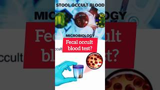 fecal occult blood test #microbiology #pathology #medicine #doctor