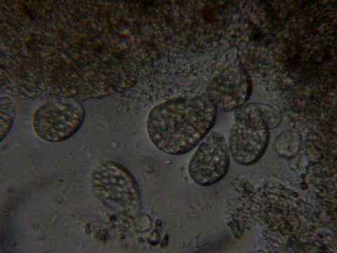 Medicine contro parassiti di helminths I lyambliya vivono in intestini