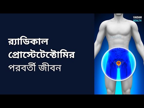 রাডিক্যাল প্রোস্টেটেক্টোমির পরবর্তী জীবন