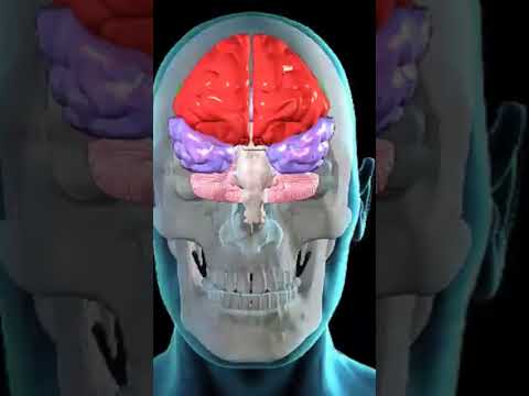 Descubre que se ve en una resonancia de cerebro 🧠