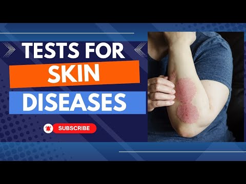 Urine test se kya pata chalta hai Qualitative analysis of urine Urinalysis test