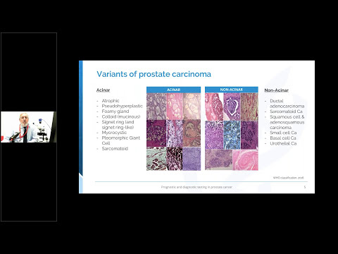 Webinar: Integrating molecular profiling in the clinical practice of prostate cancer