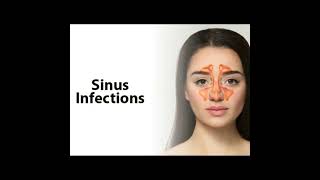 Treatment for Chronic Sinus Infection | Do you have any idea what this is and how I can treat it?