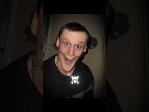 Others Mewing Vs This One ☠️ #edit #mewing #trollface #shorts #trending