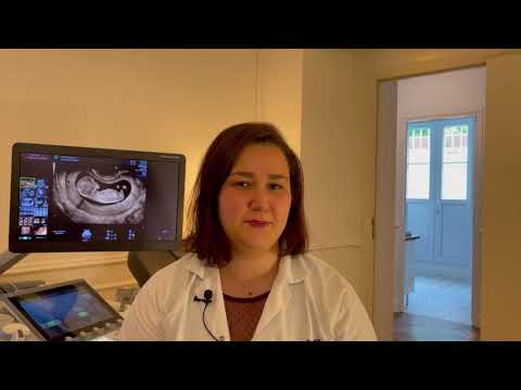 Echographie de Grossesse: peut on déterminer le sexe du futur enfant au premier trimestre ?