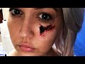 ‘The Voice’ Contestant Faces Brown Recluse Spider Bite - The Doctors ‘The Voice’ Contestant Faces Brown Recluse Spider Bite