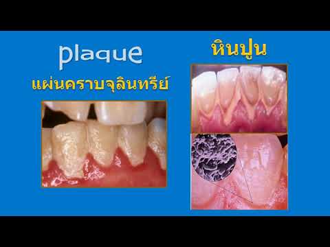 สัญญาณแรกของความอ่อนแอในผู้ชาย สาวน้อยในชายผิวดำโต้ง