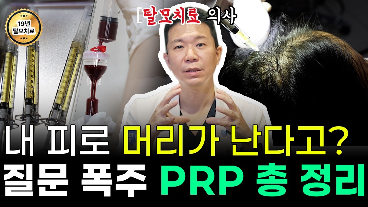 PRP、MCT Meta Cell、干细胞脱发治疗，医生坦诚解析