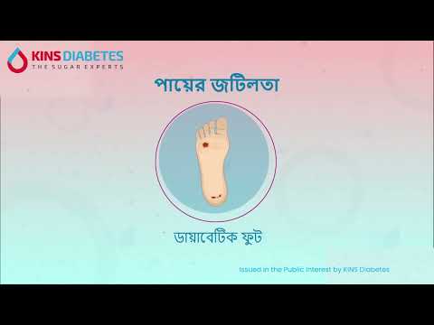 Know Your Diabetes Complications (Bengali Version)