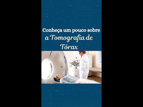 Conheça a tomografia computadorizada de tórax