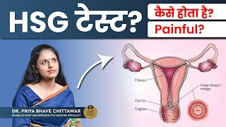 HSG (Hysterosalpingography) test क्या है और कब किया जाता है? | HSG Test in Hindi | Dr. Priya Bhave