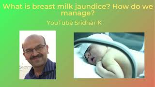 Breastmilk jaundice. Breastfeeding jaundice. How do we manage breastmilk jaundice. Dr Sridhar K