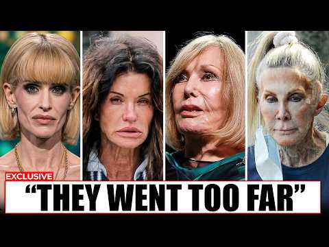 Celebrities Who Went Too Far With Plastic Surgery (Unrecognizable in 2026)