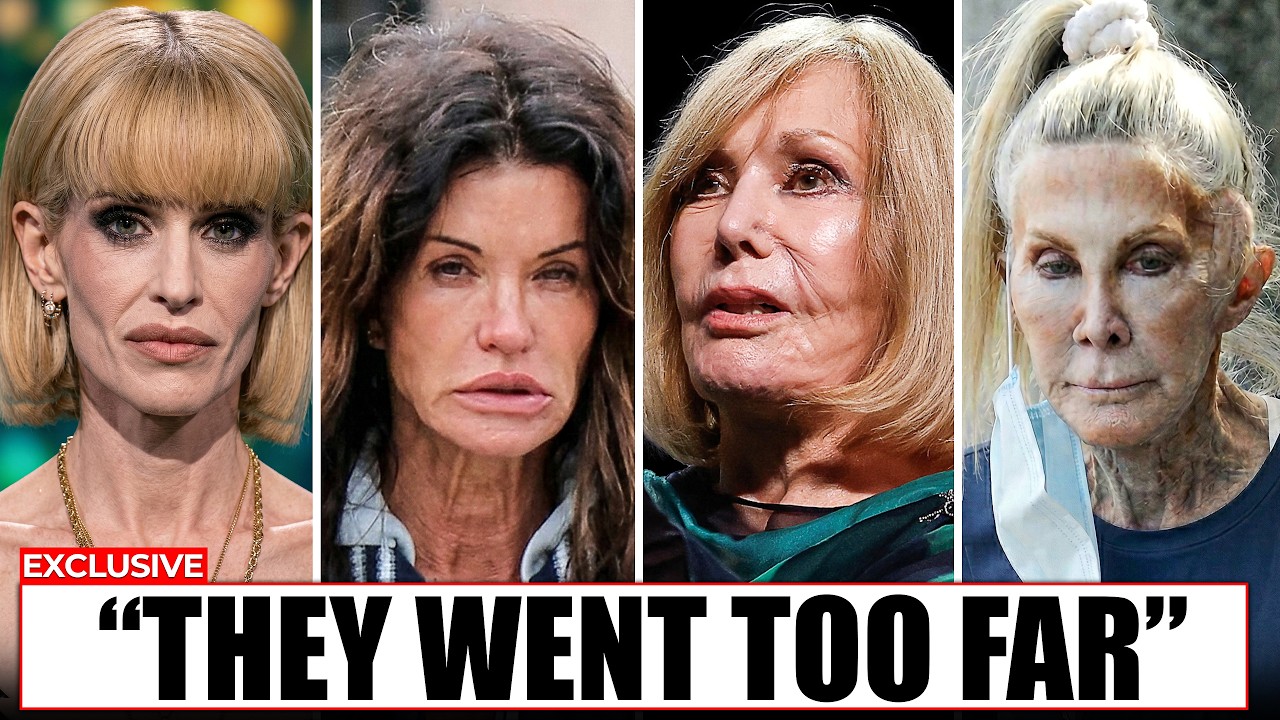 Celebrities Who Went Too Far With Plastic Surgery (Unrecognizable in 2026)
