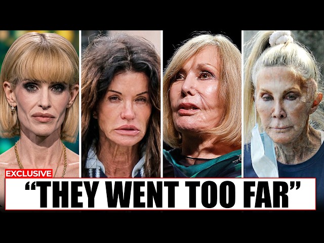 Celebrities Who Went Too Far With Plastic Surgery (Unrecognizable in 2026) SDDEFAULT Thumbnail