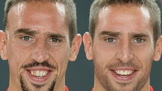 Franck Ribéry - Extreme Makeover Photoshop