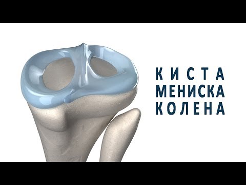 История болезни в неврологии остеохондроз Лимфатические железы шейного отдела