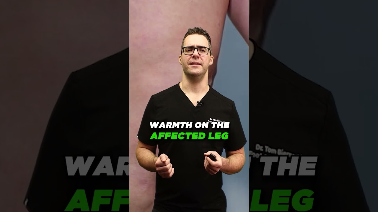 Deep Vein Thrombosis: DON'T Ignore The Warning Signs [ Blood Clot Symptoms, Tests & Diagnosis ]