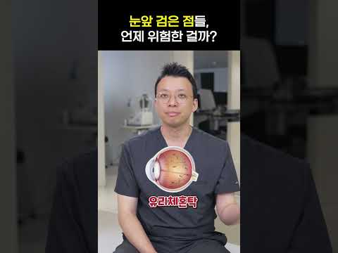 눈 앞 검은 점들, 언제 위험한 걸까? (단순 비문증 vs 망막박리 구별법)