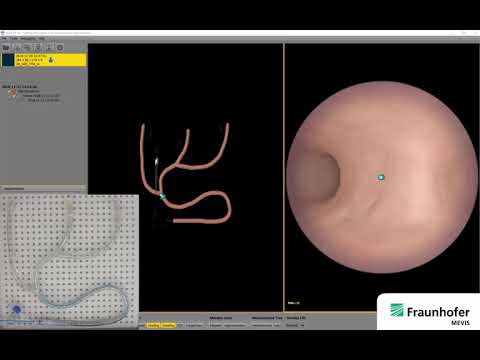 Precise Navigation Through the Vascular System