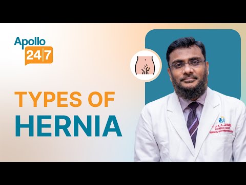 Can You Reverse a Receding Hairline Dr Monika Rajpal Apollo 24 7