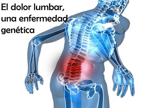 Saliente de la columna vertebral cervical y C5-6 s6-7 Presurizar la osteocondrosis cervical