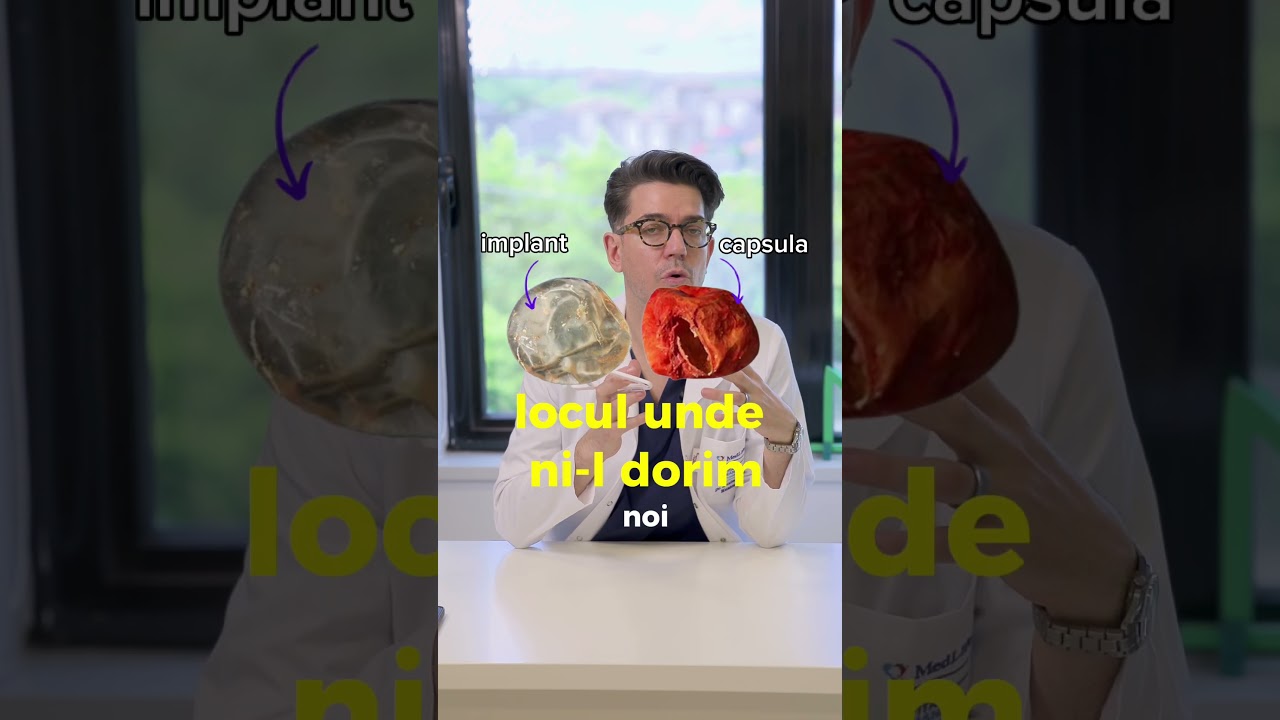 Confort și vindecare cu bustiera potrivită - sfaturi cu dr. Maximilian Muntean