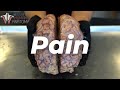 The Anatomy of Pain