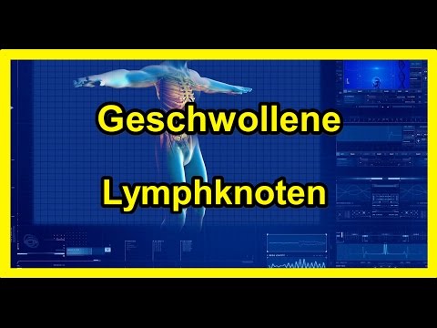 Alloplant und Osteochondrose Heilung Osteochondrose Sport