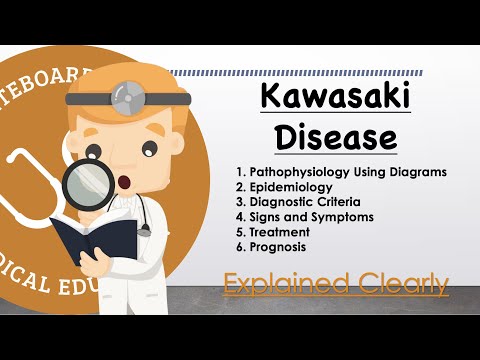Kawasaki Disease Basics - Pathophysiology, Symptoms, Management, Prognosis | Clinical Medicine