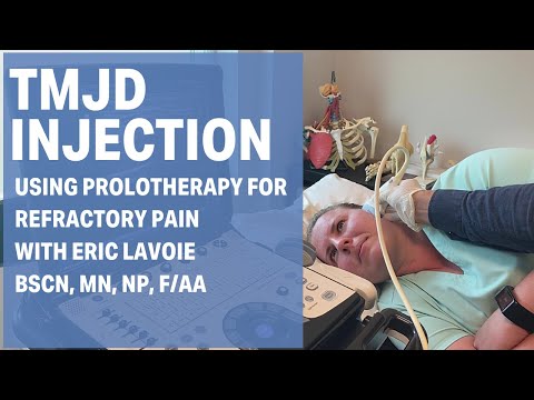 Is Prolotherapy Good for TMJD?