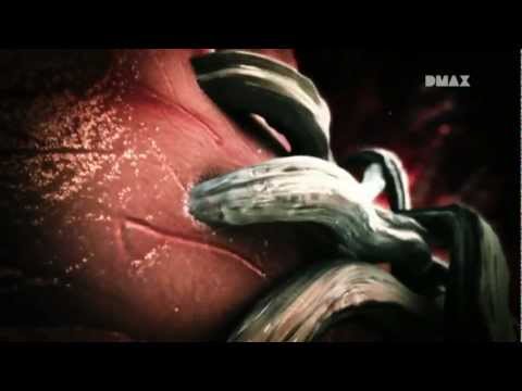 Evoluzione di parassiti e parassitismo Esistenza di parassiti in sintomi del corpo umani