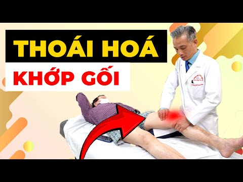 Thoái Hoá Khớp Gối: Đau Mỗi Ngày, Đi Mỗi Bước Cũng Sợ – Bao Giờ Mới Hết?