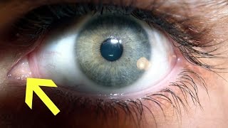 Top 10 Human Body Parts That Are Useless