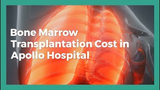 Bone Marrow Transplantation Cost In Apollo, Bone Marrow Transplant in Apollo
