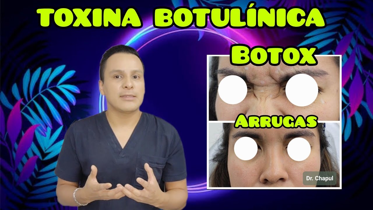 José Luis Muñoz Chapul-40