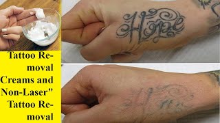 HOW I REMOVE TATTOOS WITH LEMON JUICE AND  BAKING SODA AT HOME !!! { My Experience Lightening }