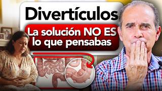 Divertículos: La Solución No Es Lo Que Pensabas