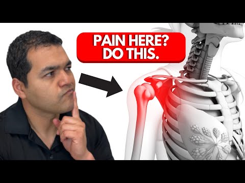 Best 5 Shoulder Impingement Exercises