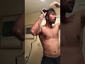 Balding Man Surprised By His New Look