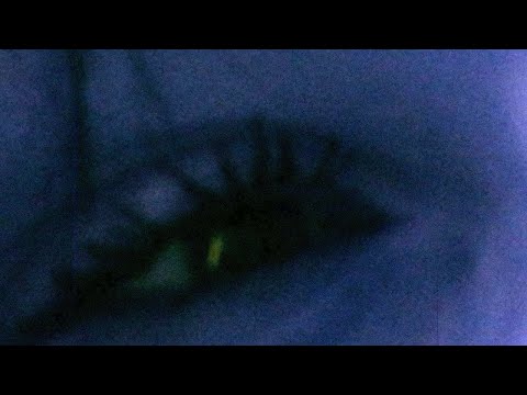 Akros - If I Die | angst Bootleg