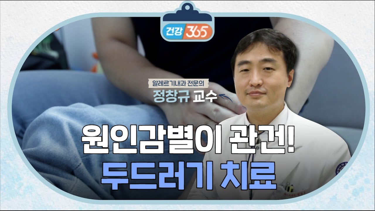 두드러기 치료 | 알레르기내과 정창규 교수 관련사진