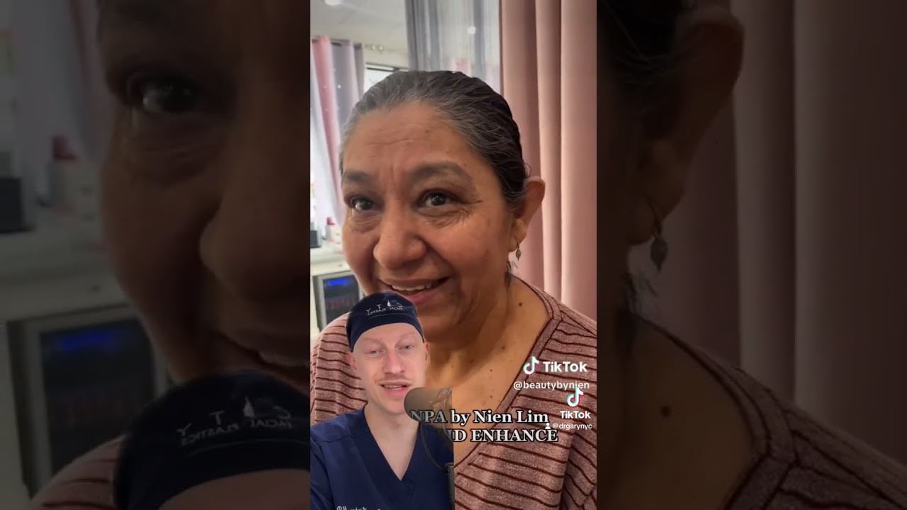 Upper Blepharoplasty Without Surgery? | Plastic Surgeon Reacts